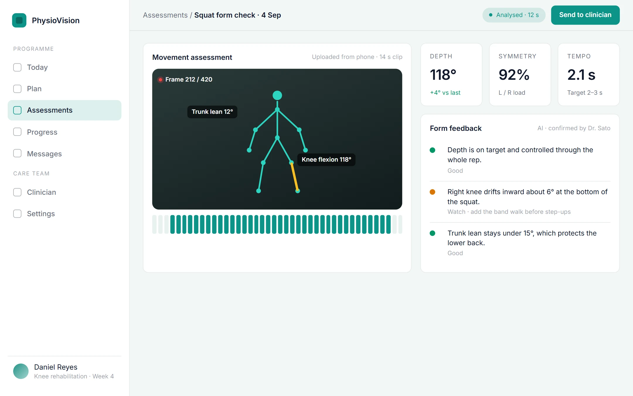 AI Physiotherapy Assistant: Movement assessment on a laptop