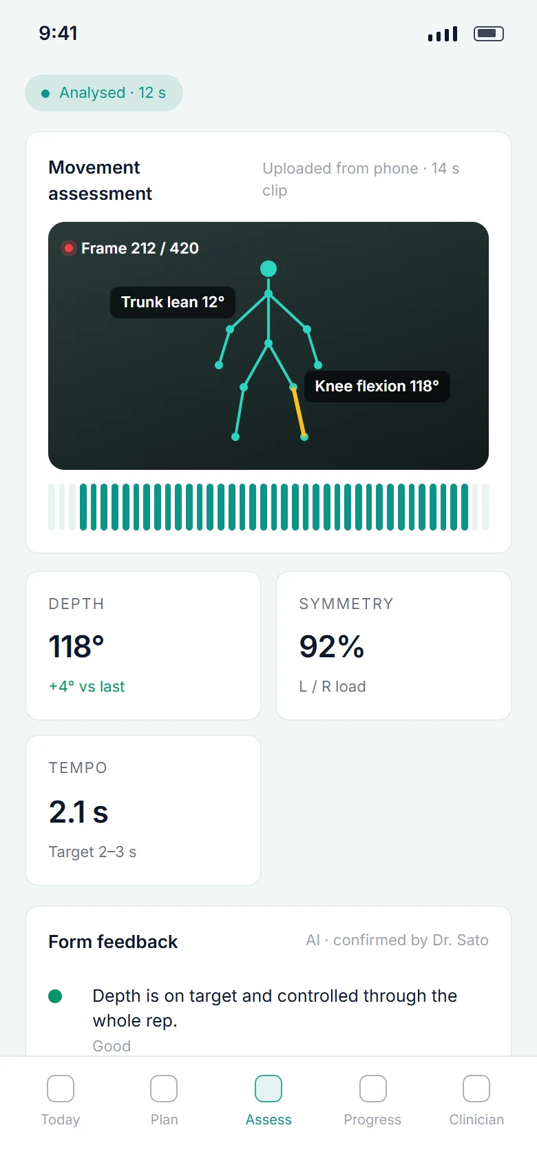 AI Physiotherapy Assistant: Movement assessment on a phone